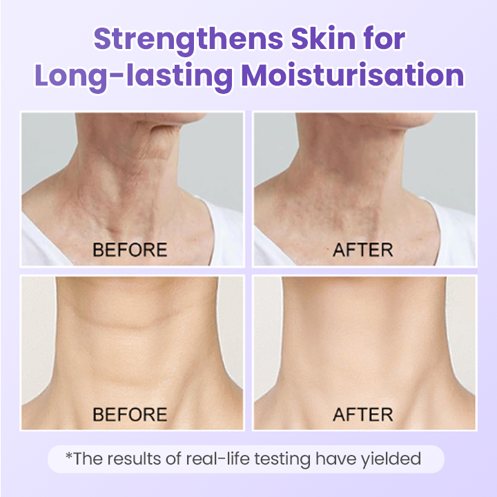 Peptide Lifting Neck Patch – Smooths Wrinkles & Firms Skin