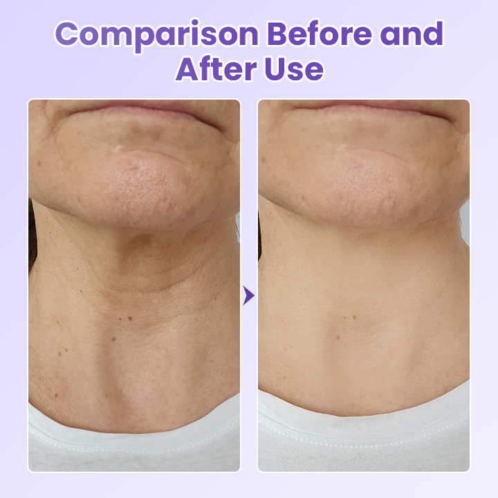Peptide Lifting Neck Patch – Smooths Wrinkles & Firms Skin