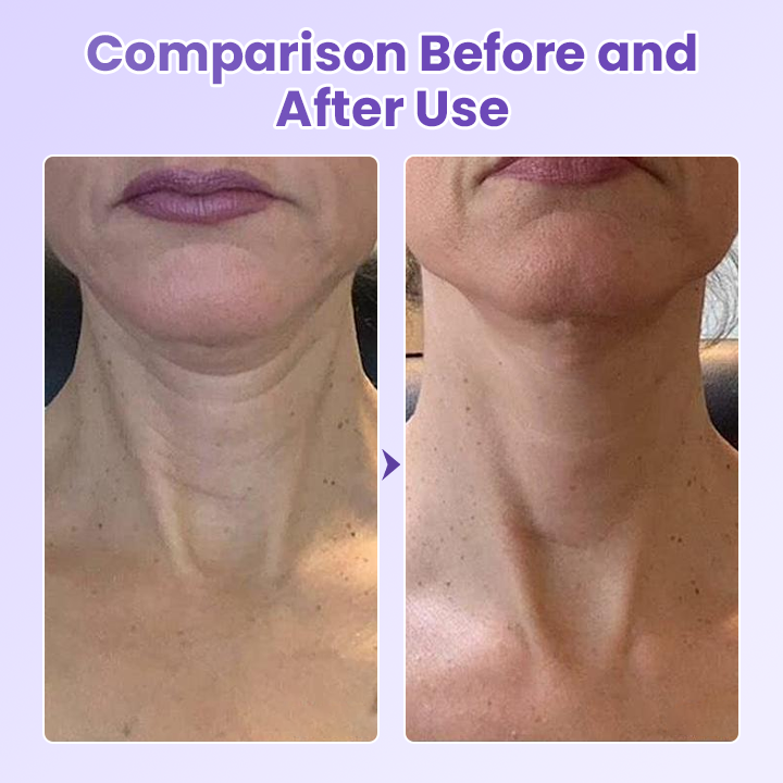 Peptide Lifting Neck Patch – Smooths Wrinkles & Firms Skin