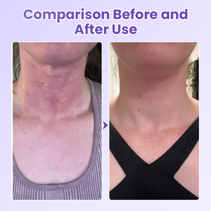 Peptide Lifting Neck Patch – Smooths Wrinkles & Firms Skin