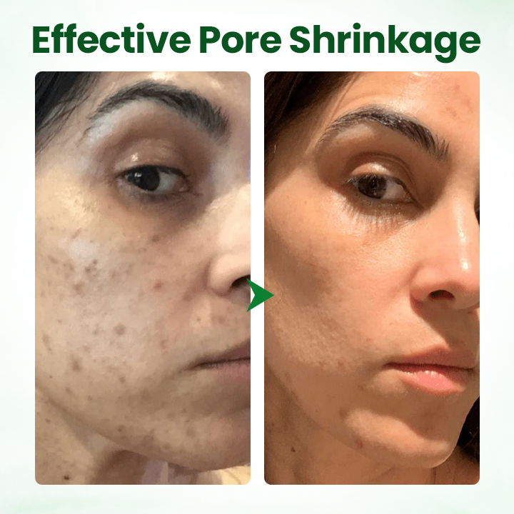 LOVILDS® PoreMelt Avocado Acid Mask