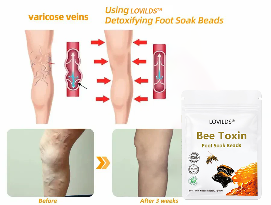 🌿LOVILDS™ Bee Toxin & 30-Herb Detox Foot Soak Beads🌲(𝐋𝐀𝐍𝐀 𝐂𝐞𝐫𝐭𝐢𝐟𝐢𝐜𝐚𝐭𝐢𝐨𝐧,𝗟𝘆𝗺𝗽𝗵𝗮𝘁𝗶𝗰 𝗔𝘀𝘀𝗼𝗰𝗶𝗮𝘁𝗶𝗼𝗻 𝗼𝗳 𝗔𝗺𝗲𝗿𝗶𝗰𝗮)