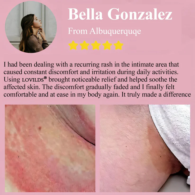 🔥 Special Deal: 60% OFF 🌸 LOVILDS® Woman's Genital HPV Healing Cream 🌸