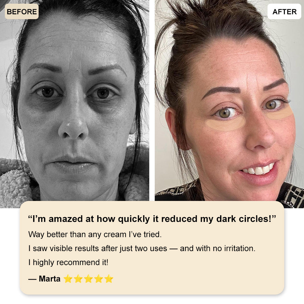 š§āāļøā³LOVILDSĀ® Deep Precision Age-Defying Nano Microneedle Patchesā Deep-Acting Solution to Say Goodbye to under-eye bags, dark circles, wrinkles, and fine lines.