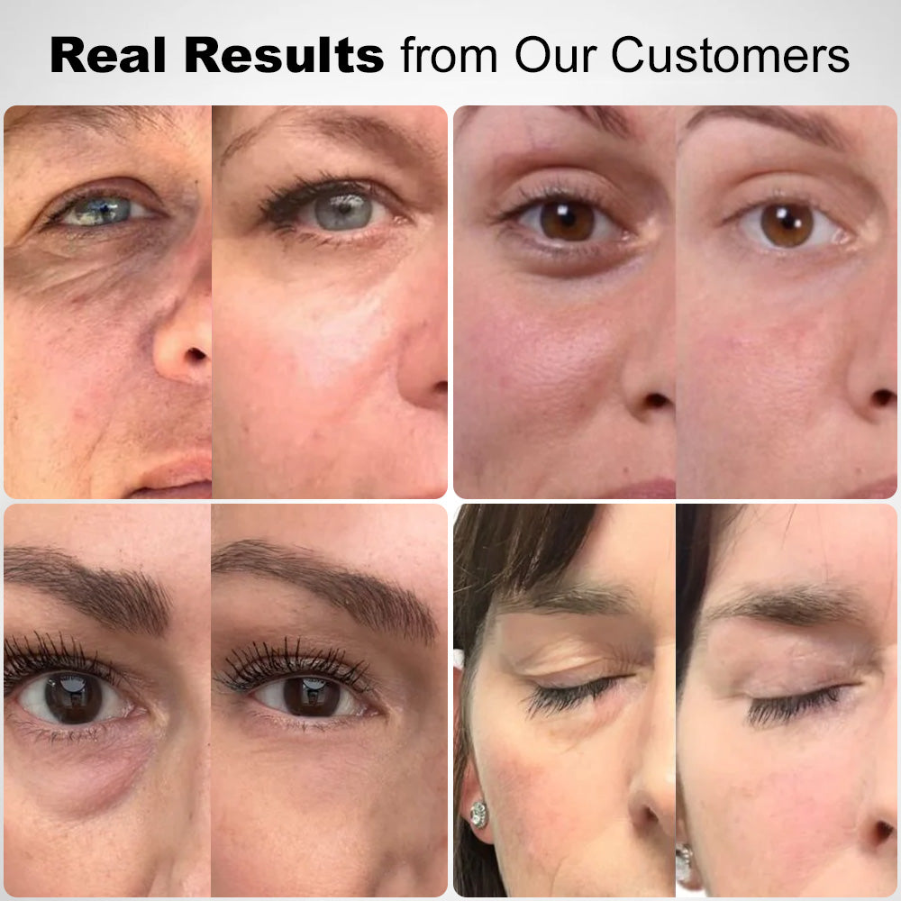 š§āāļøā³LOVILDSĀ® Deep Precision Age-Defying Nano Microneedle Patchesā Deep-Acting Solution to Say Goodbye to under-eye bags, dark circles, wrinkles, and fine lines.