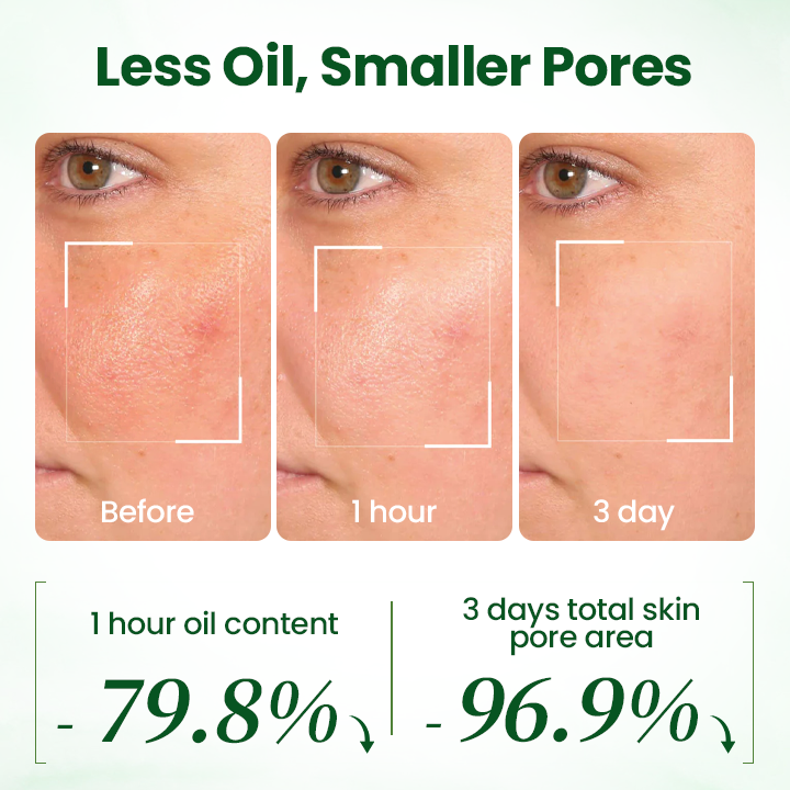 LOVILDS® PoreMelt Avocado Acid Mask