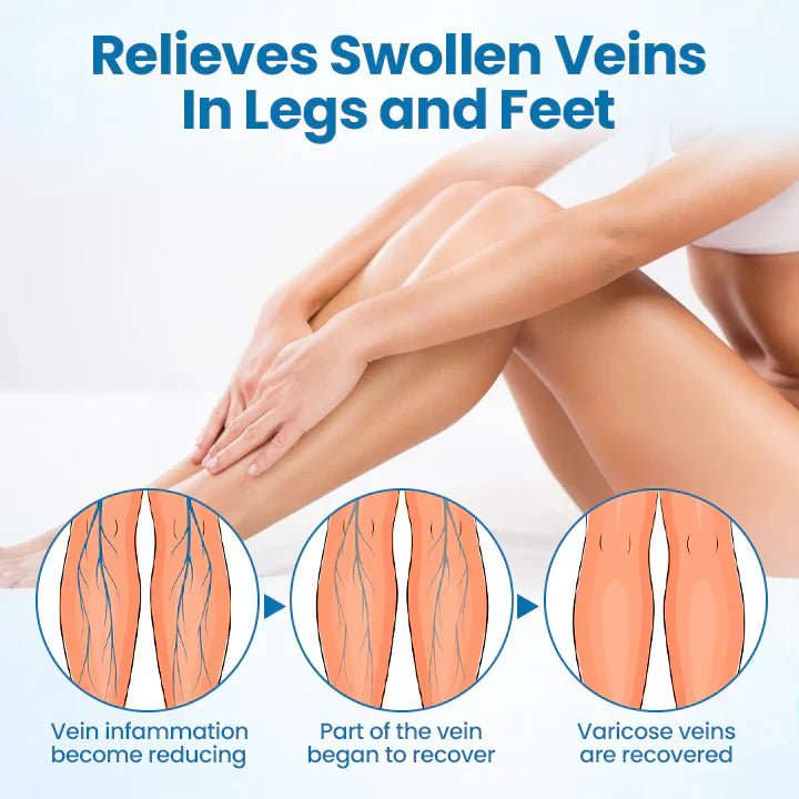 LOVILDS® VeinGuard Varicose Veins Solution Spray