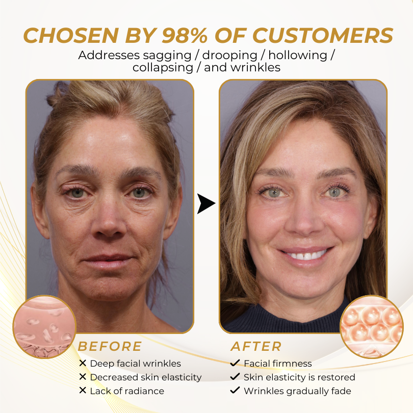 LOVILDS® FirmFlora Skin Lifting Cream