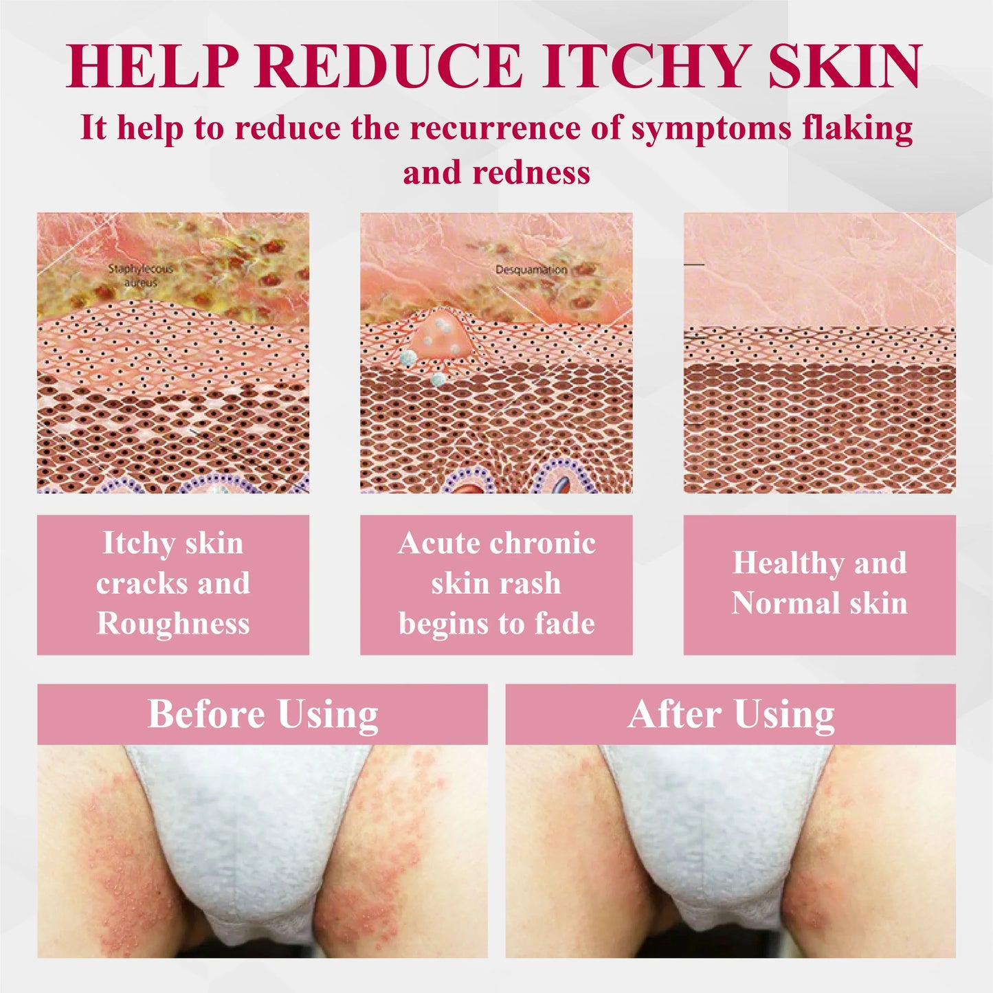 🔥 Special Deal: 60% OFF 🌸 LOVILDS® Woman's Genital HPV Healing Cream 🌸