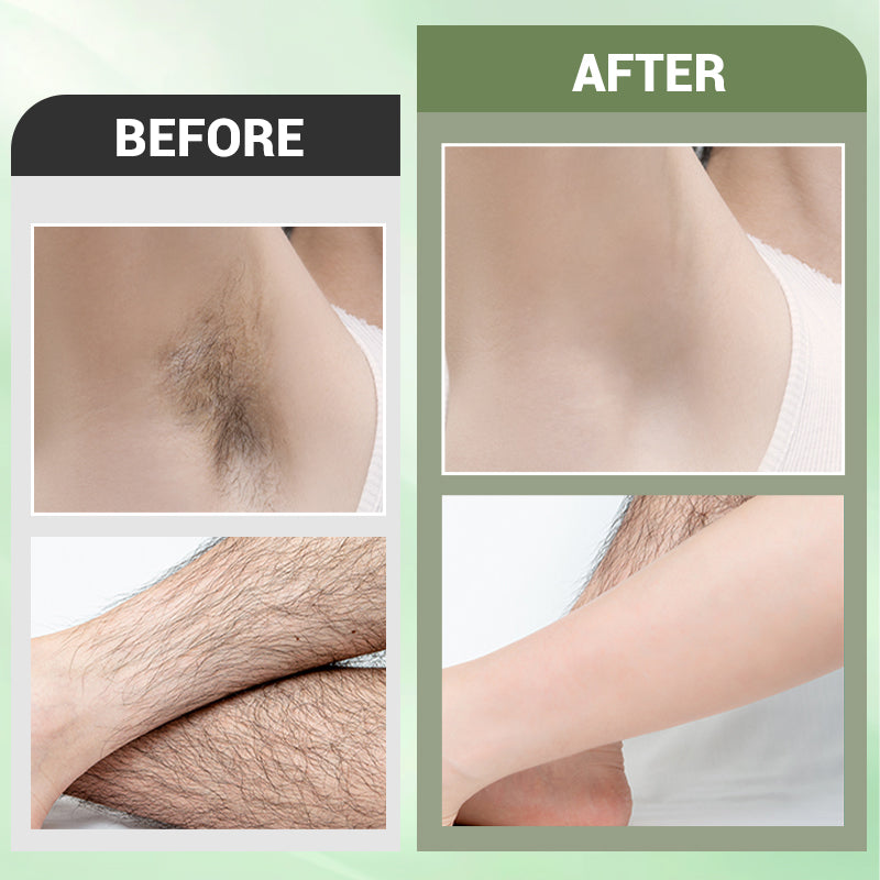 LOVILDS® Gentle 3-in-1 Hair Removal Set
