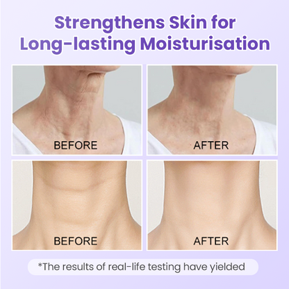 Peptide Lifting Neck Patch – Smooths Wrinkles & Firms Skin