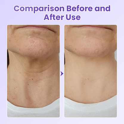 Peptide Lifting Neck Patch – Smooths Wrinkles & Firms Skin