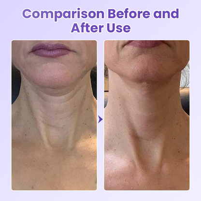 Peptide Lifting Neck Patch – Smooths Wrinkles & Firms Skin