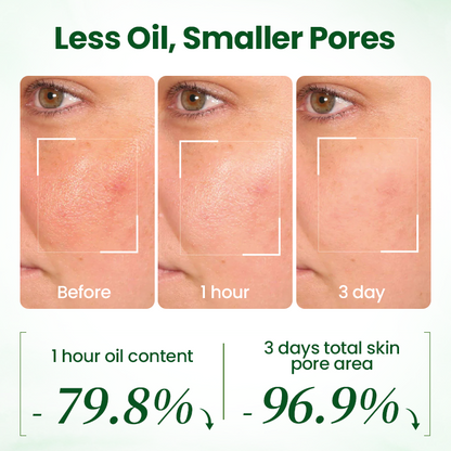 LOVILDS® PoreMelt Avocado Acid Mask