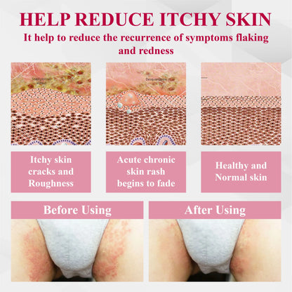 🔥 Special Deal: 60% OFF 🌸 LOVILDS® Woman's Genital HPV Healing Cream 🌸